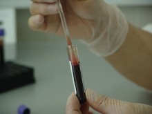Озвучены убедительные результаты КИ иммунотерапии лейкоза
